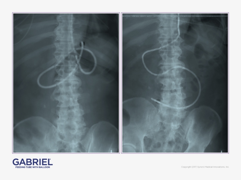 Gftb Casestudies Email 021517-1 - Medical Imaging, transparent png #3506002