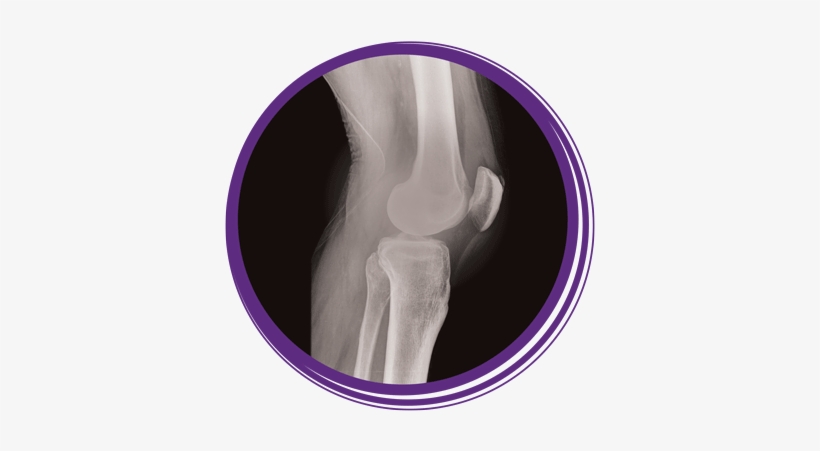 Photo Of An X-ray Of A Knee Joint - Rochelle Community Hospital, transparent png #3506174