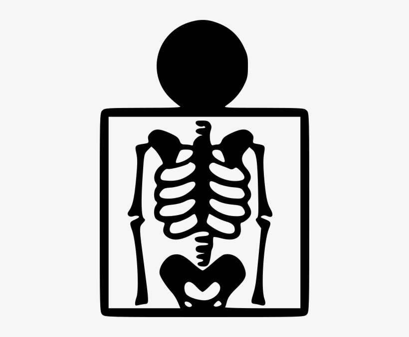 Small - X Ray Vector Icon, transparent png #3506237