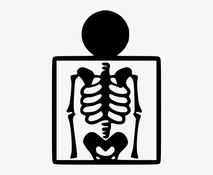 X ray рисунок
