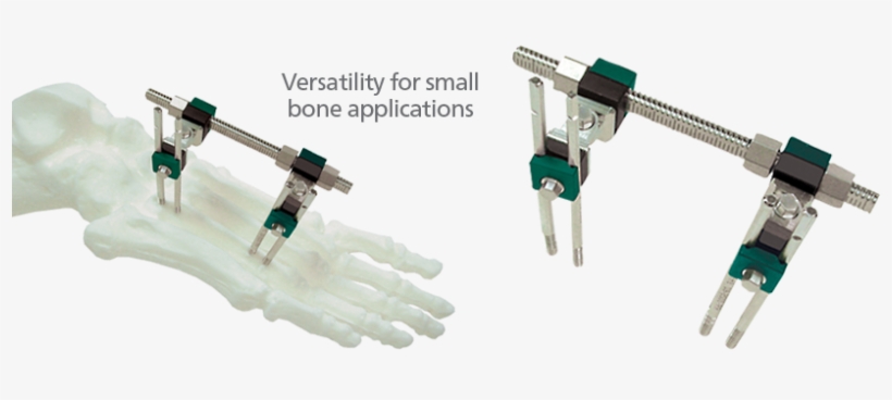 Hero Sidekick-tomahawk - External Fixation, transparent png #3516666