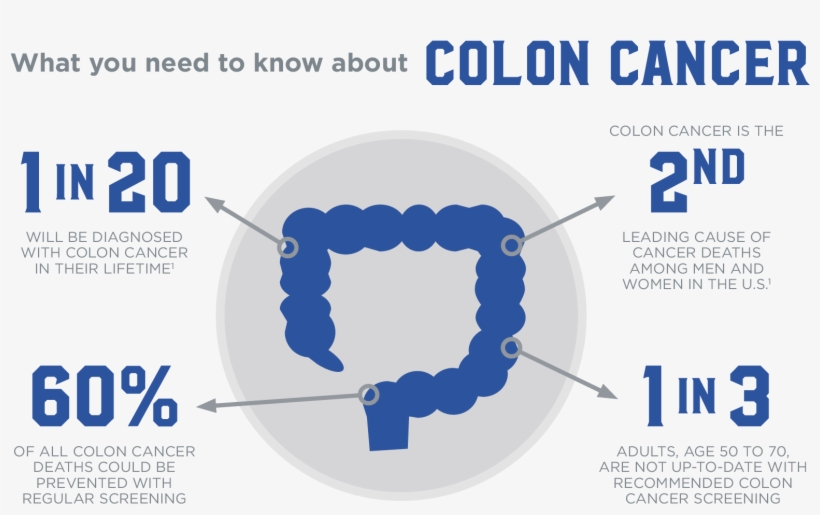 Colon Cancer Infographic - Adults Age 50 To 70 Are Not Up To Date With Recommended, transparent png #3521730