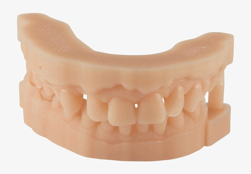 Dental Material 3d Printing For Dental Parts - 3d Printed Dental Model, transparent png #3526334