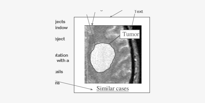 The I 2 Cnet Annotation Format Promotes The Expression - Diagram, transparent png #3537950