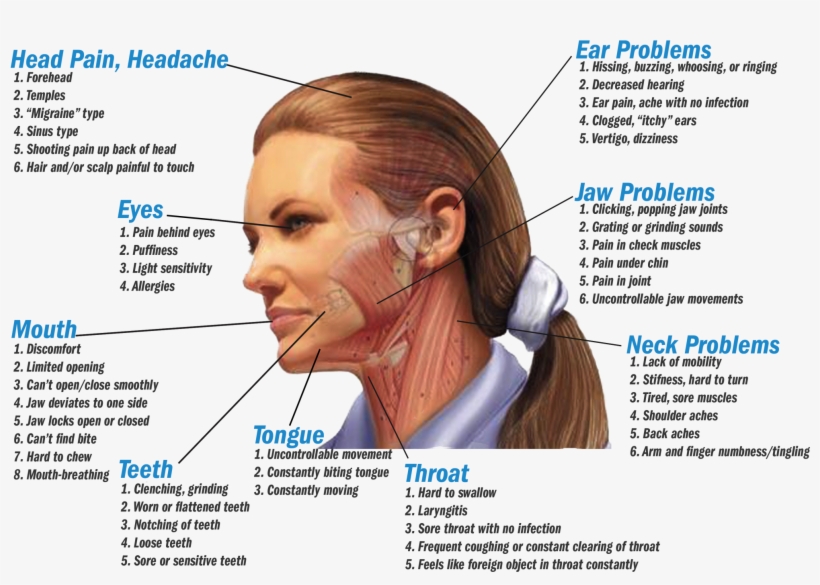 Symptoms - Dehydration Headache Pain Location, transparent png #3542596