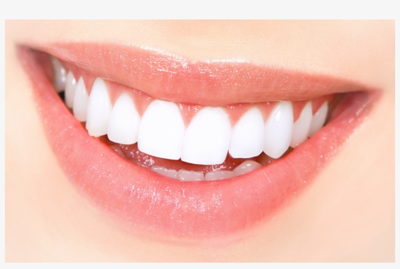 Perfect Smile2, transparent png #3545918