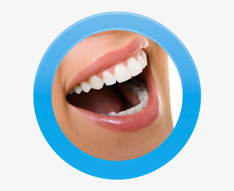 Diseño De Sonrisa - Dentistry, transparent png #3546434