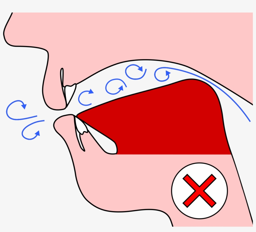 Rear Of Tongue Raised, transparent png #3601193