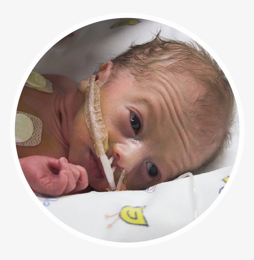 Every Human Touch Caused Her Blood Pressure To Drop - Baby, transparent png #3670777