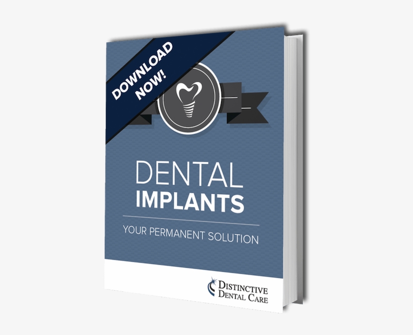 Preview Image Of Your Free Dental Implants Ebook From - Dental Implant, transparent png #3674610