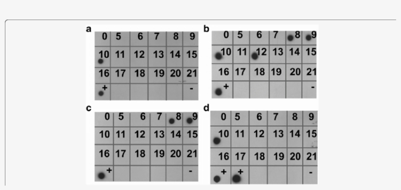 Detection Of T - Common Fig, transparent png #3674692