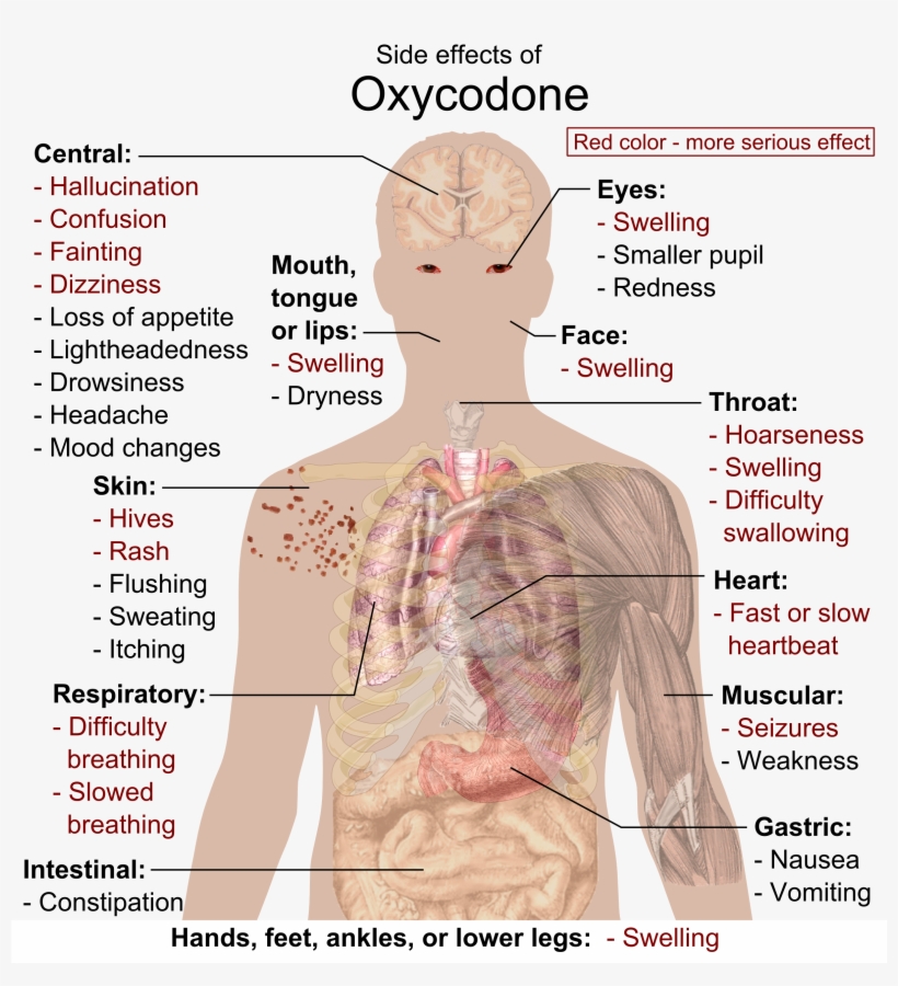 Side Effects Of Oxycodone - Cat Drug Side Effects, transparent png #3674987