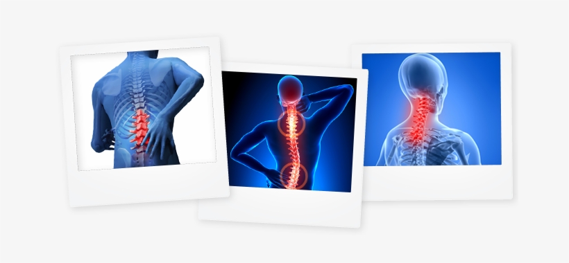 Polaroid Images Of A Persons Back With Key Areas Clearly - Salcoll Collagen Marine Collagen - Salmon Collagen, transparent png #3694960