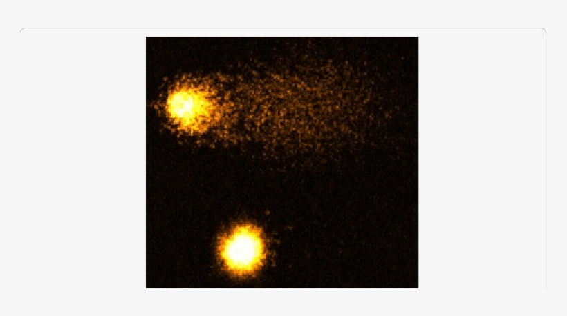 Representative Comet Images Of Hela Cells Treated With - Sun, transparent png #372791