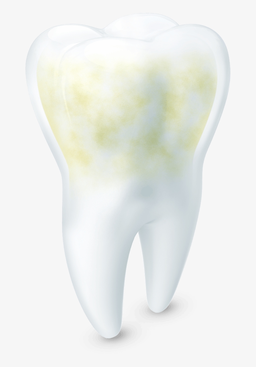 Une Dent Blanche Et Saine À Côté D'une Dent Jaunie - Acid, transparent png #376806