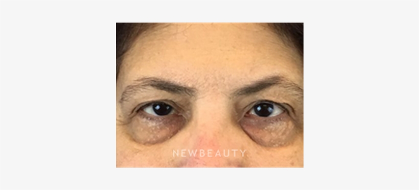 Dr Dav - Close-up, transparent png #3753502