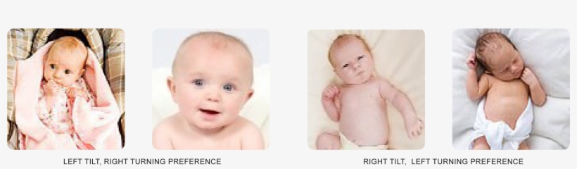 Headposturepreferences3 - “ - Torticollis Posture, transparent png #3755729