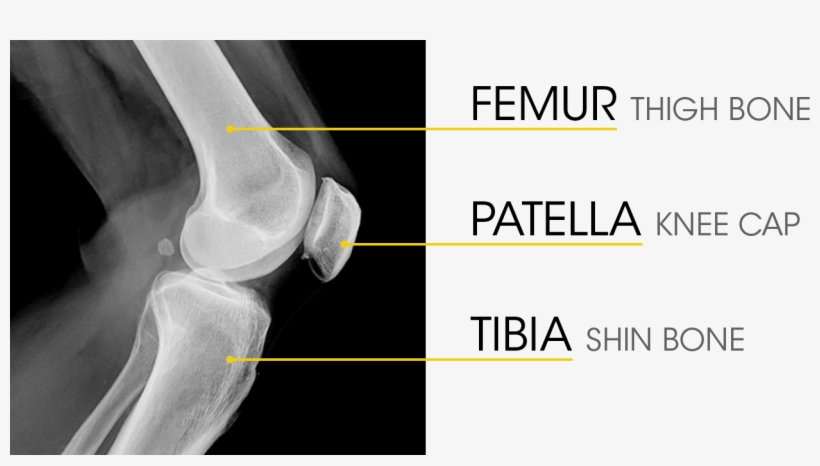 Knee Anatomy - Bone Knee, transparent png #3798236