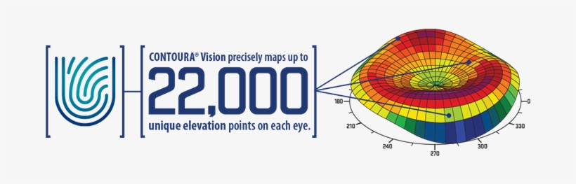 As Part Of Your Complimentary Lasik Consultation At - Diagram, transparent png #381372