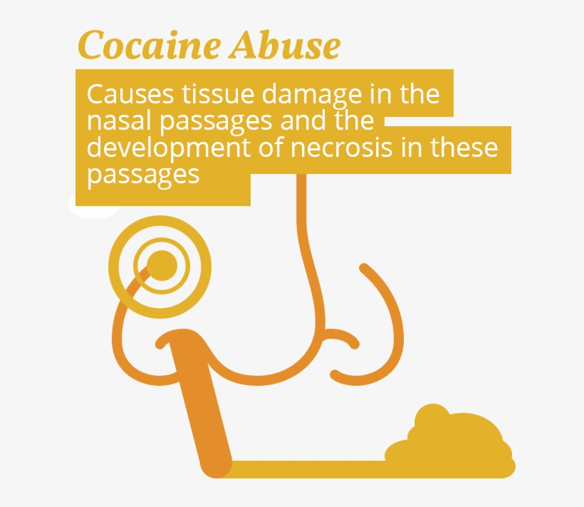 Cocaine And Nose Issues - Nasal Passage Of Cocaine Addict, transparent png #383365