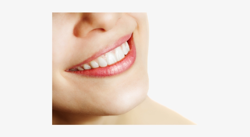 Dentist Smile Png File - Billy Bob Instant Smile Deluxe Costume Teeth: Medium, transparent png #386828