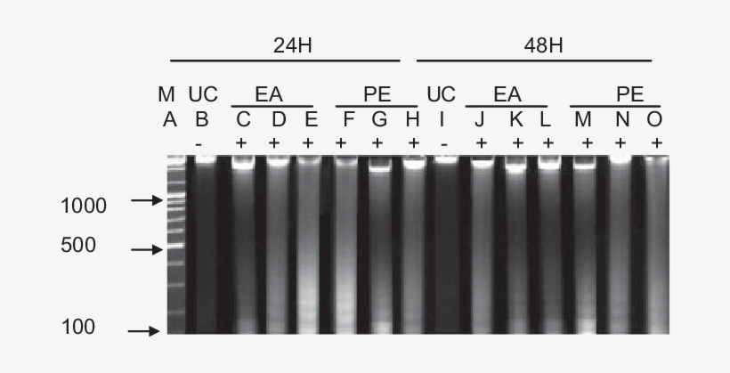 Effect Of Ea And Pe (petroleum Ether) Extracts On Dna - Number, transparent png #3815917