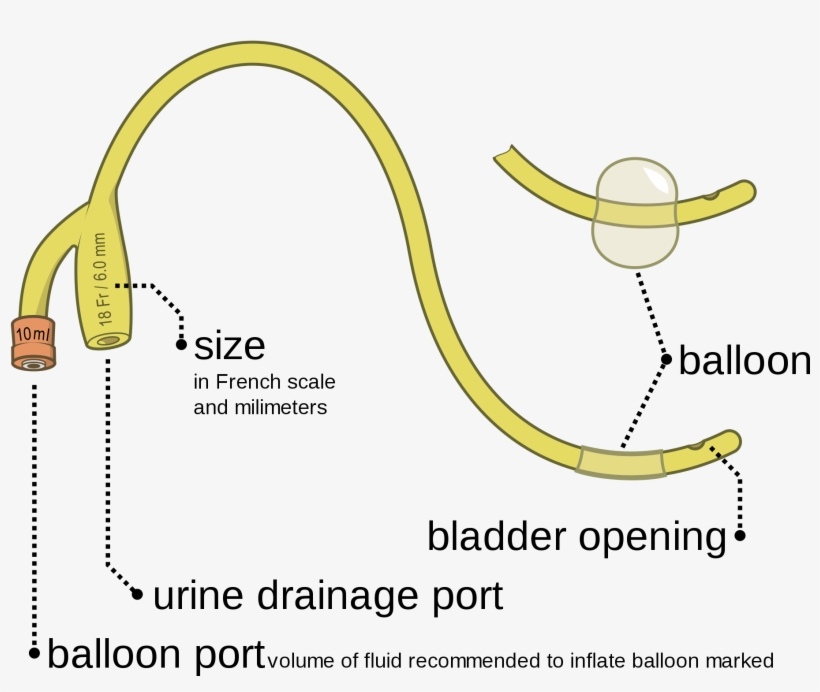 Open - 2 Way Foley Catheter, transparent png #3828438