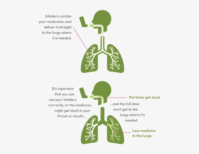 About Inhalers - Patient, transparent png #3871897