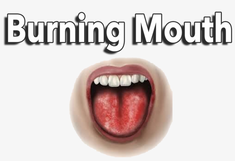 What Are The Symptoms Of Lichen Planus - Tongue, transparent png #3889289