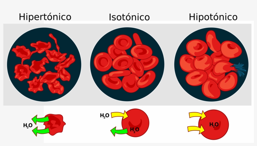 Open - Hypertonic Hypotonic Isotonic, transparent png #3931042