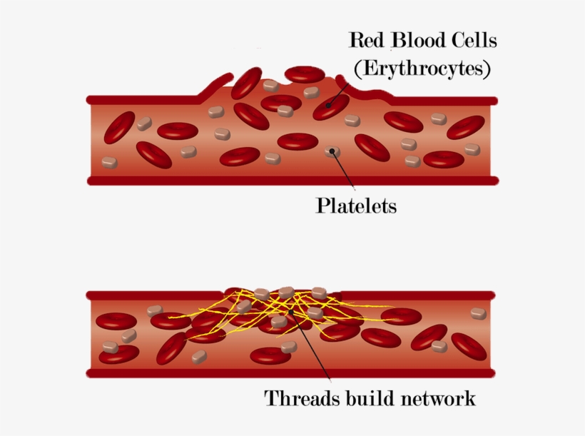 Blood Clot Formation - Damage Of Blood Vessels, transparent png #3931204