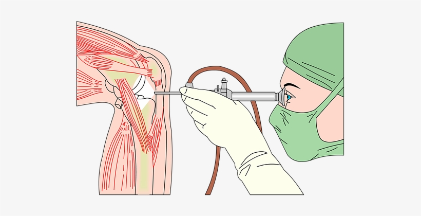 Arthroscopy-2607439 340 - Long Does It Take For Recovery After Knee Surgery, transparent png #3938936