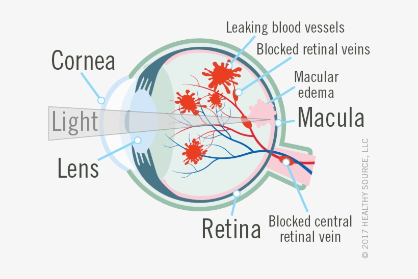 Diagram Of Eye Shows Cornea, Lens, Macula And Retina, - Diagram, transparent png #3955307
