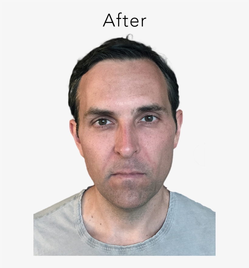 Reduce Wrinkles And Create A More Youthful Contour - Man, transparent png #3958851