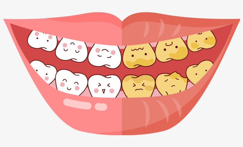 Tooth Whitening, transparent png #3977539
