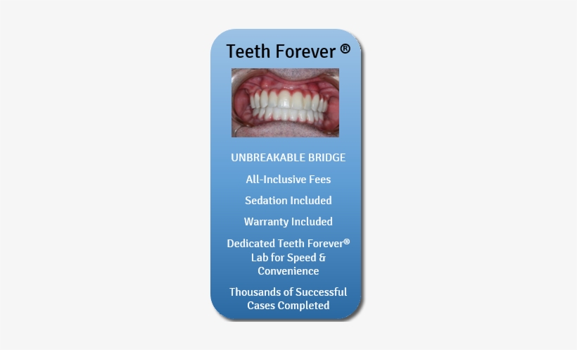 Teeth Dental Implants - Dental Implant, transparent png #3978017