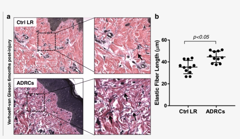Effect Of Adrcs On Elastic Fiber Length - Flower, transparent png #4010965