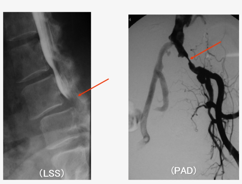 Identification Of The Causative Disease Through Walking - Leg, transparent png #4012249