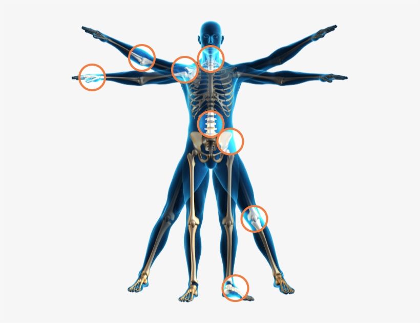 Orthopaedics, Image From - Human Body Transparent Png, transparent png #4015517