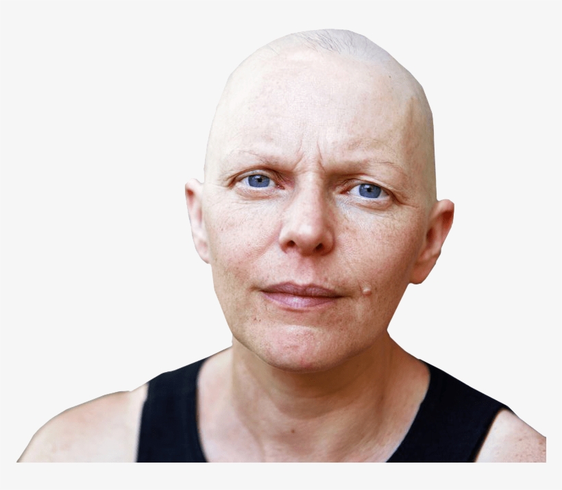 Chemo Patients, transparent png #4018929