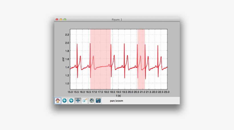 Bitalino Ecg Results Showing Heart Rate - Python Animate - Free ...