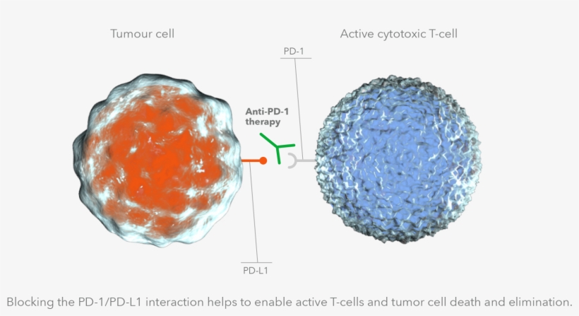 Non Small Cell Lung Cancer - Pd-l1, transparent png #4079915