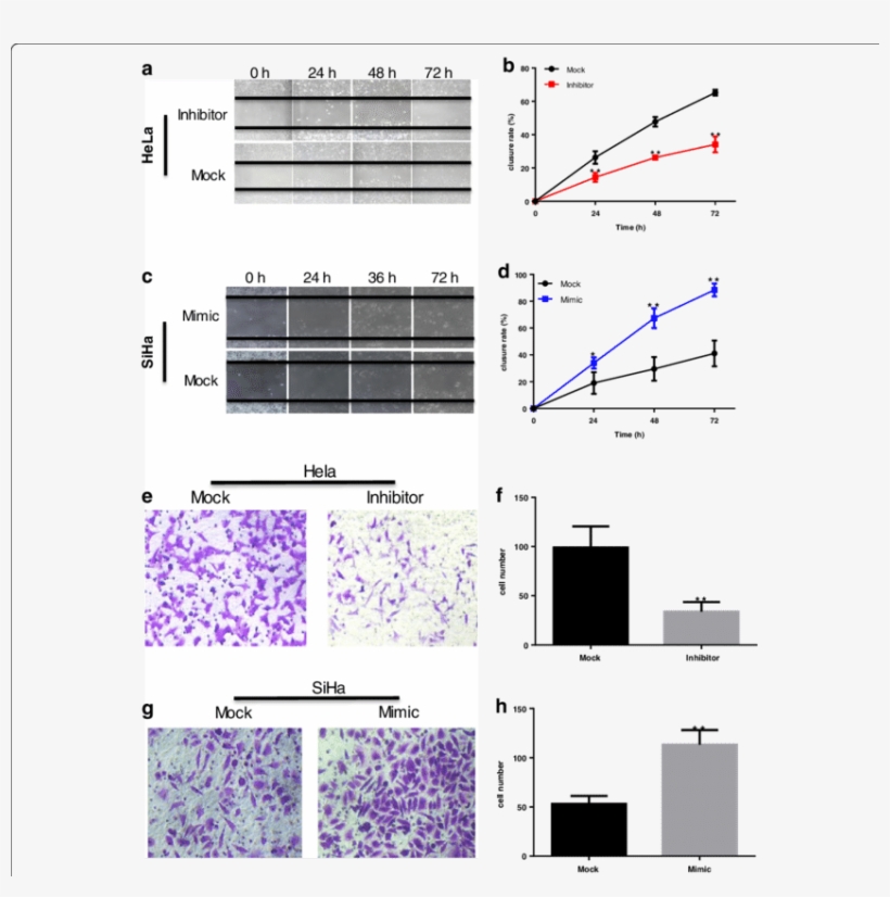 Mir 486 5p Promotes Cervical Cancer Cell Migration - Diagram, transparent png #4079964