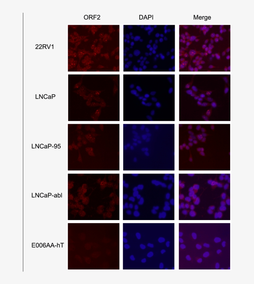 Immunofluorescence Of Endogenous Orf2p In A Panel Of - Norcantharidin, transparent png #4080054
