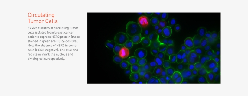 Yet, The Appearance Of Her2-positive Breast Cancer - Circulating Tumor Cell Her2, transparent png #4080464