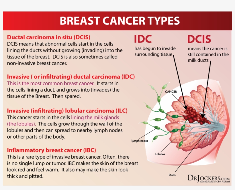 On The Other Hand, 20 To 30% Of Breast Cancer Cancers - Types Of Breast Cancer, transparent png #4080671