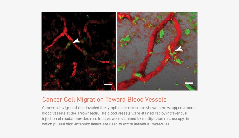 They Discovered This By Using Image Analysis, Which - Massachusetts, transparent png #4081028