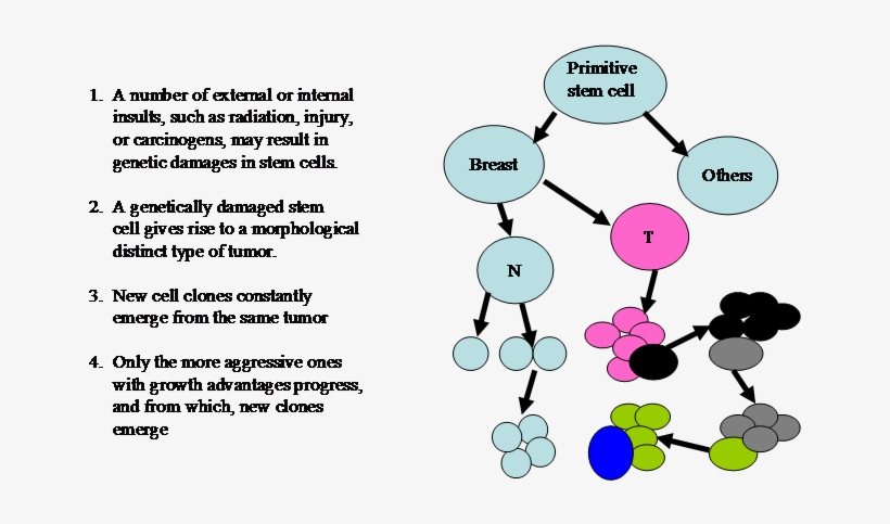 Evolution Of Breast Cancer, transparent png #4081393