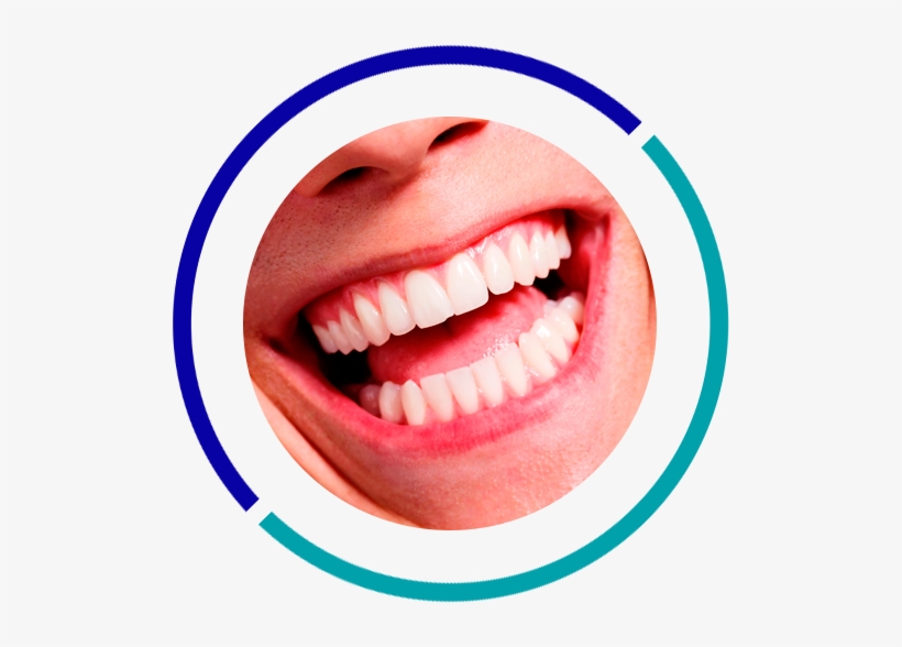 Oral Rehabilitation - White Teeth Smile With Dental Mirror, transparent png #4092166