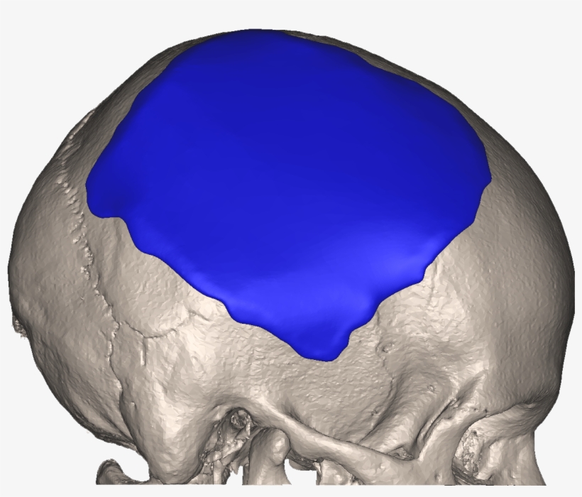 Xilloc Medical Carla Dekker Side Transparant Defect - Xilloc, transparent png #4106908